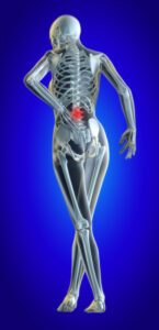 A 3d illustrated file of a womans lower back in pain showing skeleton and inflamed area