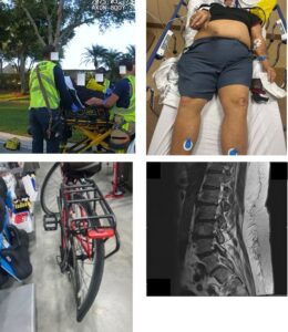 Photos of Bicycle accident, xray, damaged bike and victim on gurney with injuries